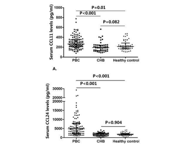 LabEx MSD平台助力原发性胆汁性胆管炎的机制研究
