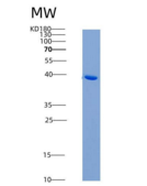 人激活素A受体ⅡB(ACVR2B)重组蛋白Fc tag