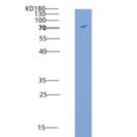 人肌醇六磷酸激酶1(IHPK1)重组蛋白His & GST tag