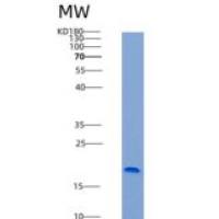 人CD300A / CMRF-35H / IGSF12重组蛋白His tag