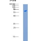 人EphB4 / HTK重组蛋白