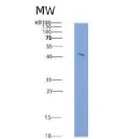 人CD300A重组蛋白Fc tag