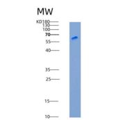 人CD1B / CD1A重组蛋白Fc tag