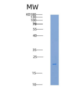 大鼠CD16a / FCGR3A重组蛋白His tag