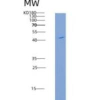 大鼠再生胰岛衍生蛋白4(REG4)重组蛋白Fc tag