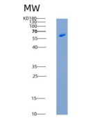 人EphB4 / HTK重组蛋白