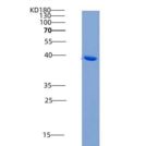 人激活素A受体ⅡB(ACVR2B)重组蛋白Fc tag