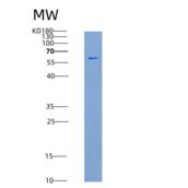 小鼠EphB1 / EPHT2重组蛋白His & GST tag