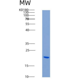 大鼠CD40 / TNFRSF5重组蛋白His tag