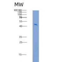 人MD1重组蛋白Fc Tag