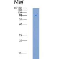 人人IFNAR1 / IFNAR重组蛋白Fc tag