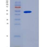 人MMP-8 / CLG1重组蛋白