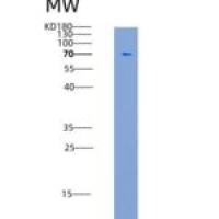 人鞘氨醇激酶1(SPHK1)重组蛋白His & GST tag