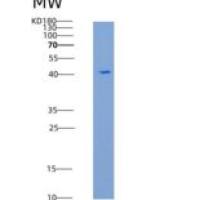 大鼠再生胰岛衍生蛋白3α(REG3a)重组蛋白Fc tag