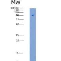 小鼠NEK3重组蛋白His & GST tag