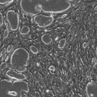 HEP-53.4 小鼠肝癌细胞
