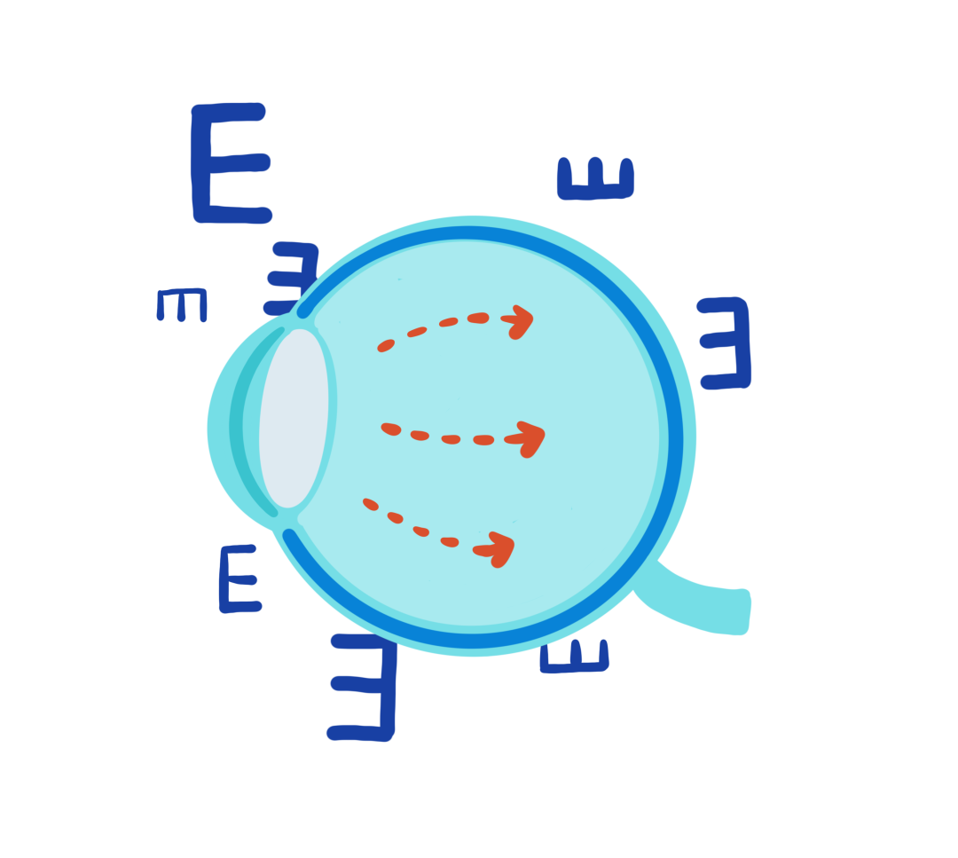 全国爱眼日讲座：青光眼动物模型的构建方法及应用案例