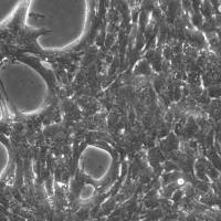HEP-53.4 小鼠肝癌细胞
