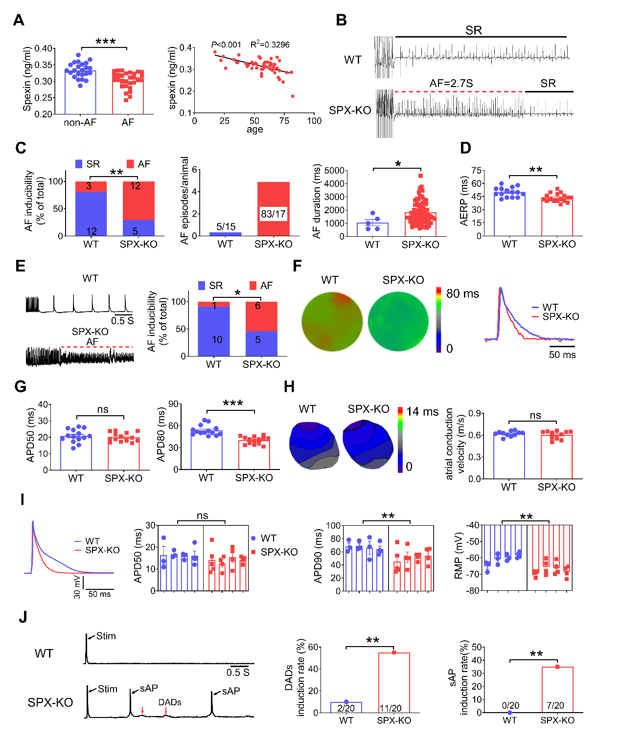 哈尔滨医科大学杨宝峰院士团队提出心房颤动的治疗新思路