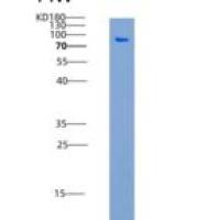人ERN1 / IRE1重组蛋白aa 465-977, His & GST tag