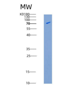 人TLK2 / PKU-ALPHA重组蛋白aa 397-77