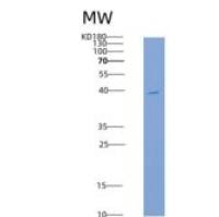 人成纤维细胞生长因子受体4(FGFR4)重组蛋白His tag