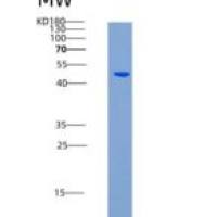 人AK4 / Adenylate Kinase 4 / AK3L1重组蛋白His & GST tag