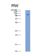 人CSF1R / MCSF Receptor / CD115