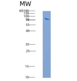 人TAOK3 / JIK / MAP3K18重组蛋白aa 1