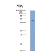 小鼠CSK / C-Src重组蛋白