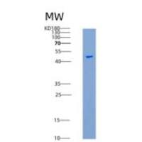 小鼠CSK / C-Src重组蛋白