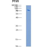 人TAOK3 / JIK / MAP3K18重组蛋白aa 1-411, His & GST tag