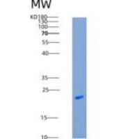 人CLEC4D / CLECSF8重组蛋白His tag