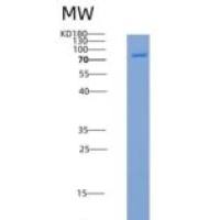 人CSF1R / MCSF Receptor / CD115重组蛋白His & GST tag