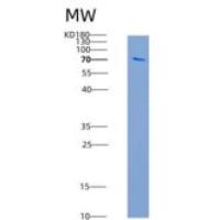 人AKT2 / protein kinase B / PKB beta重组蛋白His & GST tag