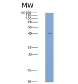 大鼠FCGRT & B2M Heterodimer重组蛋白