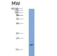 人Flavokinase / RFK重组蛋白His tag