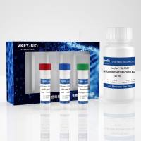 KeyTec® TR-FRET Hybridoma screening kit (His antigen, Mouse IgG) (1,000 tests)