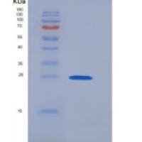 大鼠CD89 / FCAR重组蛋白His tag