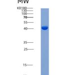 人IL-1R9 / IL1RAPL2重组蛋白His tag