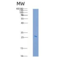 大鼠EpCAM / TROP-1 / TACSTD1重组蛋白His tag