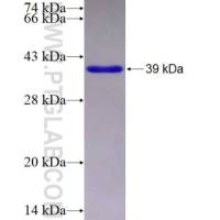 CHMP4C 融合蛋白