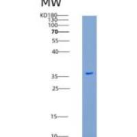 人FLT1重组蛋白His Tag