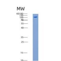 小鼠c-MET / HGFR重组蛋白Fc tag