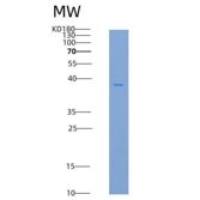 人IL1R2 / IL1RB / CD121b重组蛋白His tag