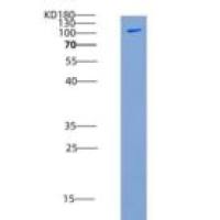 人己糖激酶3(HK3)重组蛋白His & GST tag