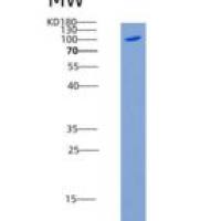 人TLK1 / PKU-beta重组蛋白His & GST tag