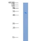 小鼠IFNGR1 / CD119重组蛋白Fc tag