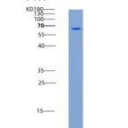 人MUSK Kinase重组蛋白aa 433-783, His & GST tag
