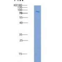 人EphA2重组蛋白aa 585-976, His & GST Tag
